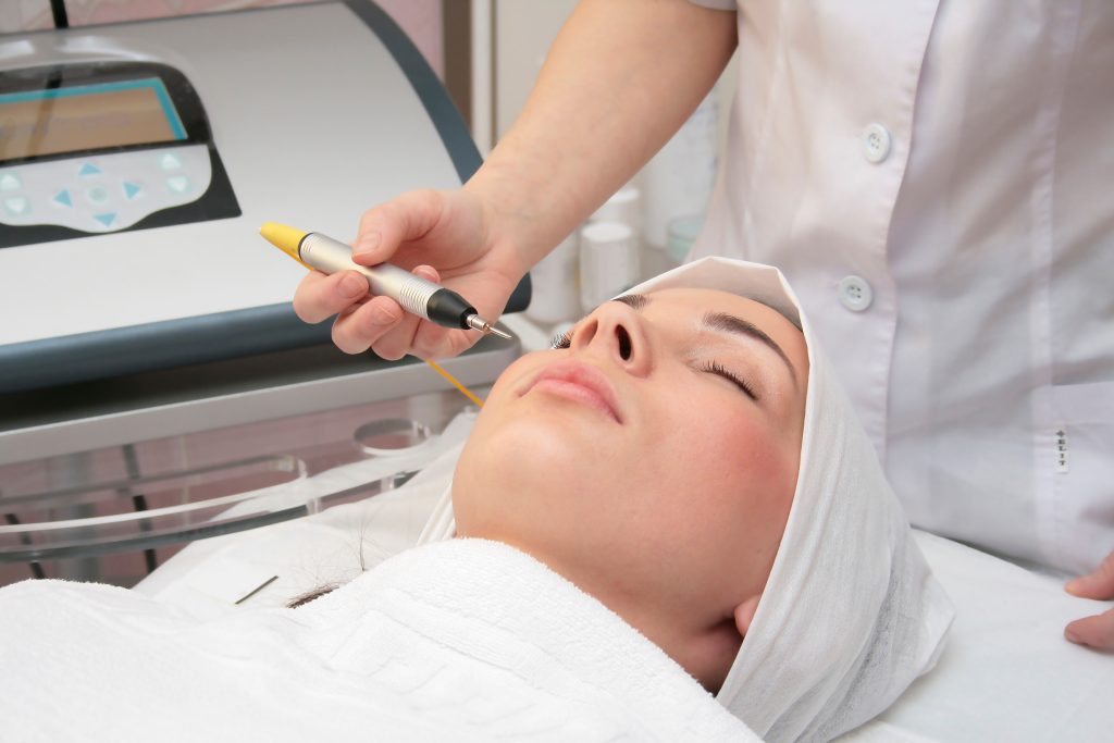 Séance d'épilation électrique